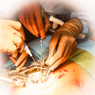 Minimally Invasive Cardiac Surgery