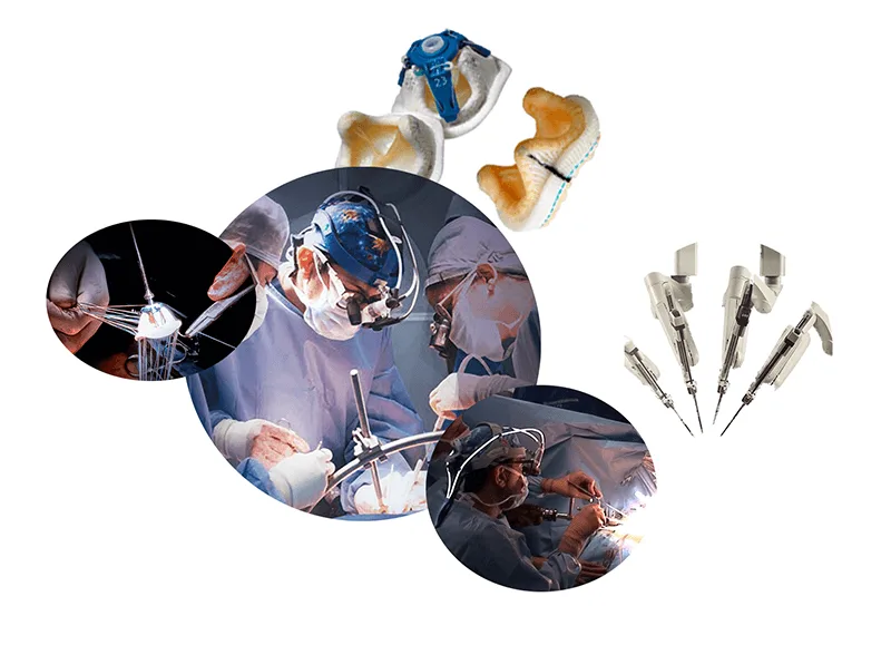 Minimally Invasive Cardiac Surgery Minimally Invasive Options
