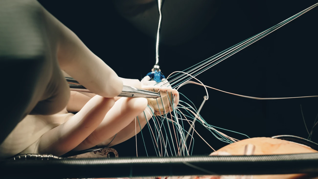 Minimally Invasive Heart Valve Surgery MICS