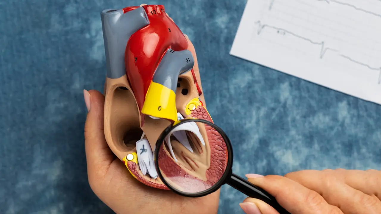 What to Do After Being Diagnosed with Mitral Valve Regurgitation