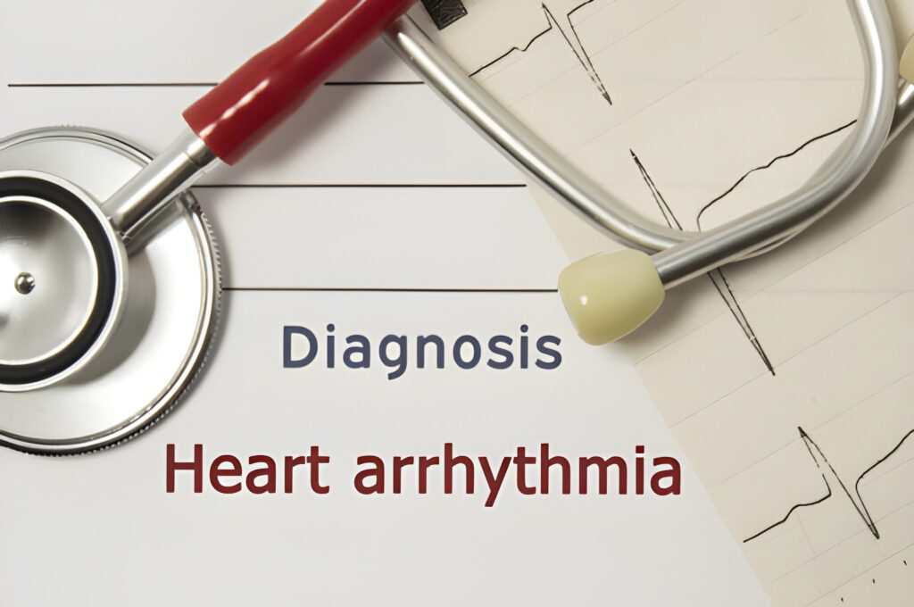 Heart Arrhythmia