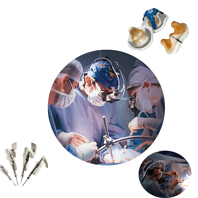 Minimally Invasive Heart Surgery by Dr Sathyaki Nambala
